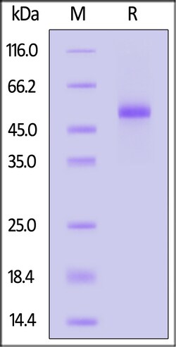 ACROBiosystems Biotinylated Cynomolgus DLL3 Protein, His,Avitag, Quantity: