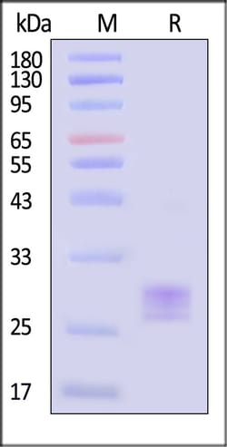 ACROBiosystems Human TNF-beta / Lymphotoxin-alpha Protein, His Tag (MALS