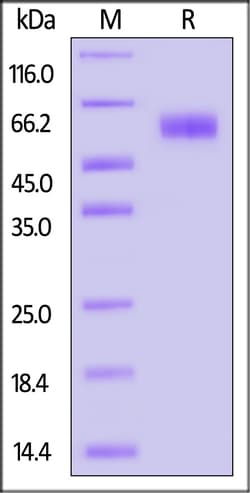 ACROBiosystems Human LILRB1 / CD85j / ILT2 (23-431) Protein, His Tag (MALS