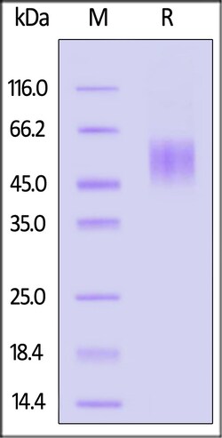 ACROBiosystems Mouse uPAR / PLAUR Protein, His Tag (SPR verified), Quantity: