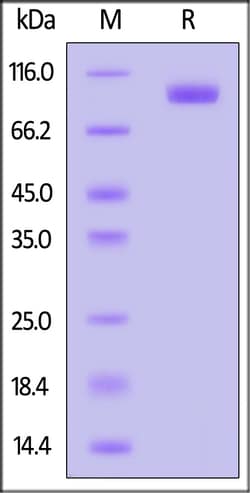 ACROBiosystems Biotinylated Human AXL Protein, Fc,Avitag (MALS verified),