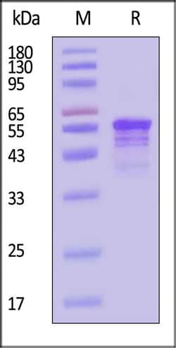 ACROBiosystems Human Tau-441 / 2N4R Pre-formed Fibrils Protein, Tag Free,