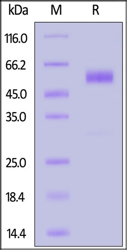 ACROBiosystems Human GCGR / Glucagon receptor Protein, Fc Tag (MALS verified),