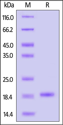 ACROBiosystems Human Alpha-Synuclein (A53T) Protein, His Tag (MALS verified),