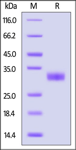ACROBiosystems Rabbit Angiopoietin-2 / ANGPT2 Protein, His Tag (MALS verified),