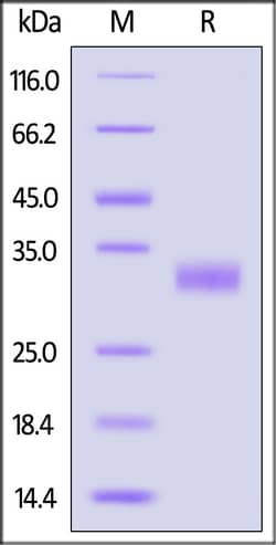 ACROBiosystems Human Adiponectin Protein, His Tag, Quantity: Each of 1