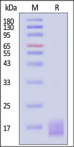 ACROBiosystems Biotinylated Human LY6G6D Protein, His,Avitag, Quantity:
