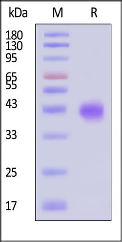 ACROBiosystems Human FSH alpha & beta Heterodimer Protein, His Tag, Quantity: