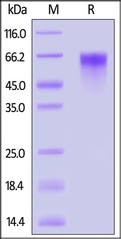 ACROBiosystems Mouse LIV-1 / SLC39A6 (C153A, C300A) Protein, His Tag (MALS