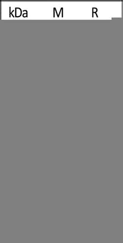 ACROBiosystems Human Tau-441 (K18, P301L) Protein, Tag Free (HPLC verified),