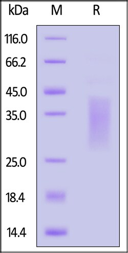 ACROBiosystems Human TRGC1 Protein, His Tag, Quantity: Each of 1