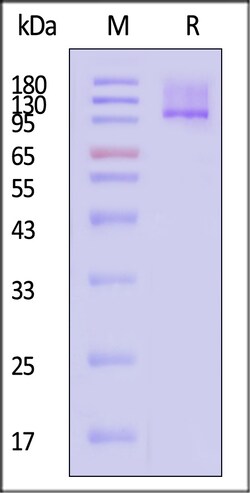 ACROBiosystems Human TGF-beta RIII / TGFBR3 Protein, His Tag, Quantity: