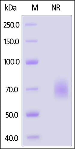 ACROBiosystems Cynomolgus / Rhesus macaque OX40 Ligand Protein, His Tag,