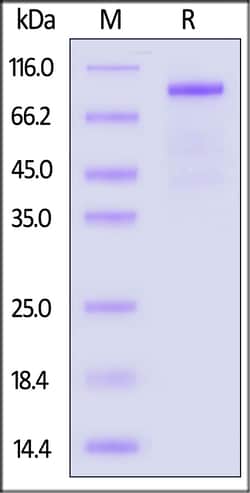 ACROBiosystems Biotinylated Mouse IL-12 R beta 1 / CD212 Protein, His,Avitag,