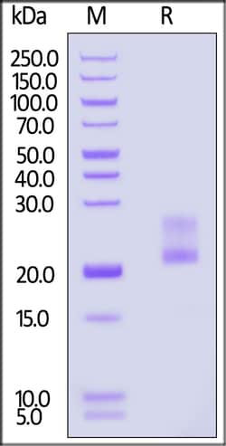 ACROBiosystems Mouse IFN-gamma / IFNG Protein, His Tag (MALS verified),