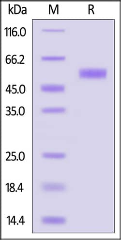 ACROBiosystems Human Mesothelin / MSLN (391-598) Protein, Fc Tag (MALS