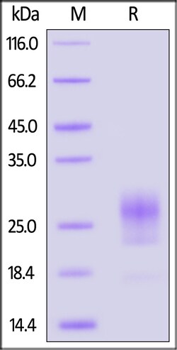 ACROBiosystems Mouse IL-7 Protein, His Tag, Quantity: Each of 1