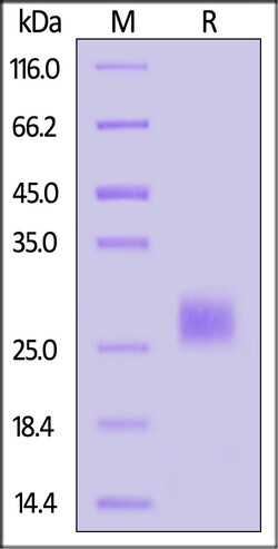 ACROBiosystems Human Oncostatin M (OSM) (26-221) Protein, Tag Free (MALS