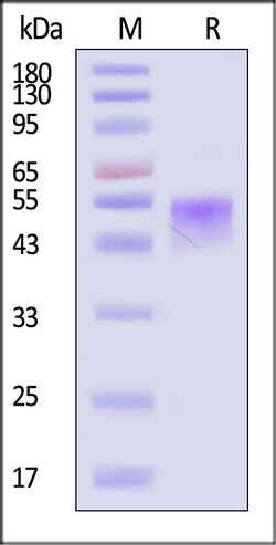 ACROBiosystems Cynomolgus IL-2 R alpha / CD25 Protein, His Tag (MALS verified),