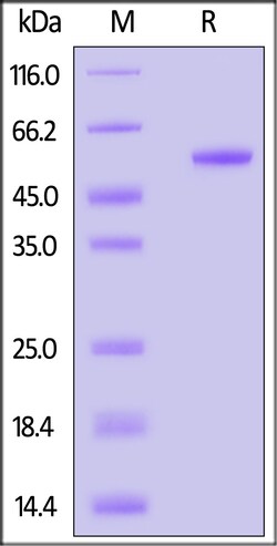 ACROBiosystems Biotinylated Human IL-17B Protein, Fc,Avitag (MALS verified),