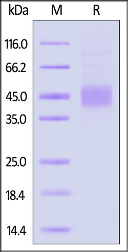 ACROBiosystems Biotinylated Mouse IL-21 R Protein, His,Avitag, Quantity: