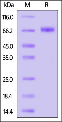 ACROBiosystems Mumps virus (strain Miyahara vaccine) (MuV) HN Protein,