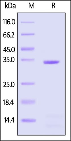 ACROBiosystems Mouse Apolipoprotein E Protein, His Tag (MALS & SPR verified),