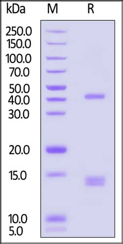 ACROBiosystems Human HLA-A*02:01&B2M&WT-1 (RMFPNAPYL) Tetramer Protein
