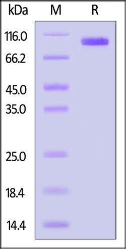 ACROBiosystems Biotinylated Human CDCP1 Protein, His,Avitag (MALS verified),