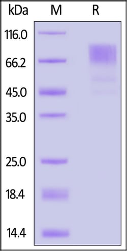 ACROBiosystems Biotinylated Mouse GUCY2C / Guanylyl cyclase C Protein,