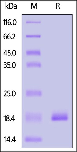 ACROBiosystems Monkeypox virus (strain Zaire-96-I-16) L1R Protein, His