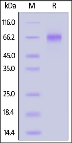 ACROBiosystems Human Coagulation factor IX / F9 Protein, His Tag (active