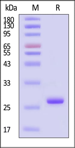 ACROBiosystems HIV (HV1-HXB2) Capsid protein p24, His Tag (MALS verified),