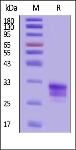 ACROBiosystems Mouse TL1A Protein, His Tag (MALS verified), Quantity: Each