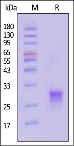 ACROBiosystems Biotinylated Human TL1A / TNFSF15 Protein, His,Avitag, Quantity: