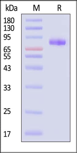 ACROBiosystems Biotinylated Human IL-12 R beta 1 / CD212 Protein, His,Avitag