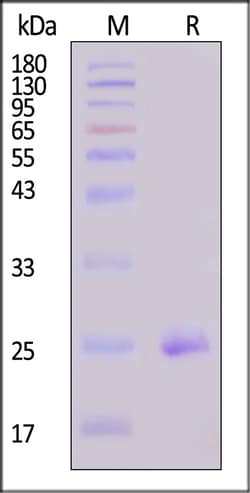 ACROBiosystems Human Claudin-4 Protein, His,Twin-Strep Tag (Detergent),