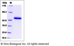 Sino Biological Recombinant Mouse PEDF/Serpin F1 Protein (His Tag), Quantity: