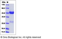 Sino Biological Rhesus NOV Protein 100ug (Sino Biological), Quantity: Each