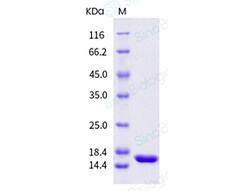 Sino Biological Recombinant Mouse TNF-alpha Protein (ECD), Quantity: Each