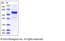 Sino Biological Mouse KLRB1F Protein 50ug (Sino Biological), Quantity: