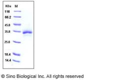 Sino Biological Recombinant Human TFPI2 Protein (His Tag), HPLC-verified,