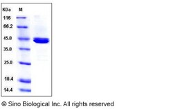 Sino Biological Mouse CPB1 Protein 50ug (Sino Biological), Quantity: Each