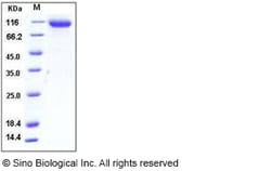 Sino Biological Mouse ASAH2 Protein 50ug (Sino Biological), Quantity: Each