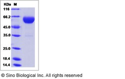 Sino Biological Rat CPB2 Protein 100ug (Sino Biological), Quantity: Each