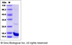 Sino Biological Human CEBPG Protein 1MG (Sino Biological), Quantity: Each