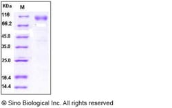 Sino Biological Human TNFRSF21 Protein 1MG (Sino Biological), Quantity: