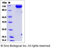 Sino Biological Rat CD22 Protein 100ug (Sino Biological), Quantity: Each