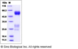 Sino Biological Rat GGT1 Protein 100ug (Sino Biological), Quantity: Each