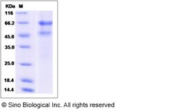 Sino Biological Rhesus ADAM8 Protein 20ug (Sino Biological), Quantity:
